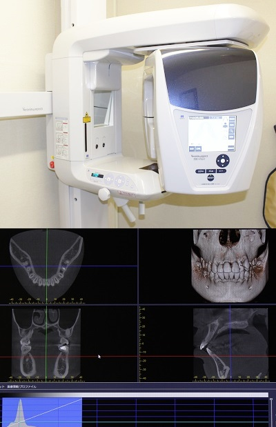 デジタルレントゲン／歯科用CT